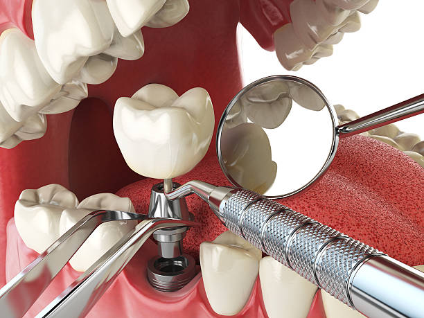 Best Emergency Treatment for Jaw Pain or Injury in Morenci, MI
